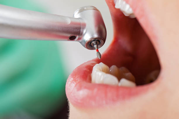 Best Emergency Tooth Extraction in Strum, WI